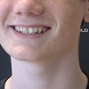 Callum Eade