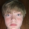 Wyatt Lynch